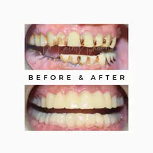 Before After 4